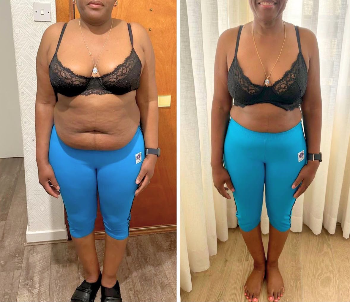 Antes e depois de aluna: redução de gordura abdominal